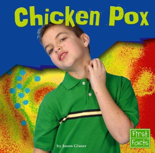 CHICKEN POX